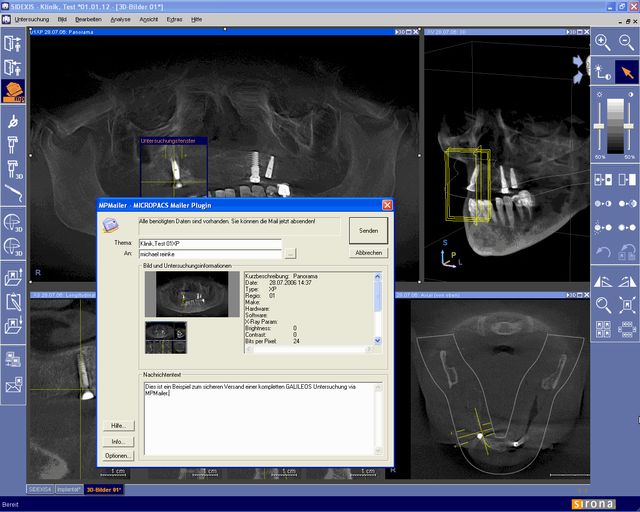 Integration des MPMailer DirectDental Plugins in die SIRONA SIDEXIS Anwendung. Mit dem MPMailer Plugin können auch 3D GALILEOS Untersuchungsdaten in einer sicheren Teleradiologieumgebung übertragen und kommuniziert werden.